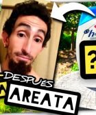 Empecé a PERDER el PELO y Tomé una Decisión (ALOPECIA AREATA) by mixim89